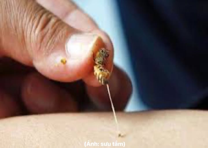 CẢNH BÁO NGUY HIỂM KHI BỊ ONG ĐỐT